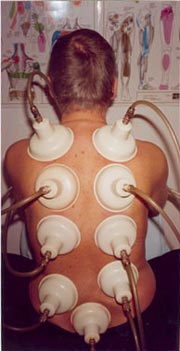 Back treatment